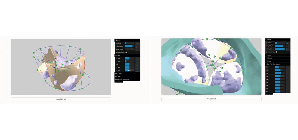 pre-procedural-fit-testing-transcatheter-aortic-valve-replacement-tavr-valves-using-parametric-modeling-3d-printing-4 pre-procedural-fit-testing-transcatheter-aortic-valve-replacement-tavr-valves-using-parametric-modeling-3d-printing-4